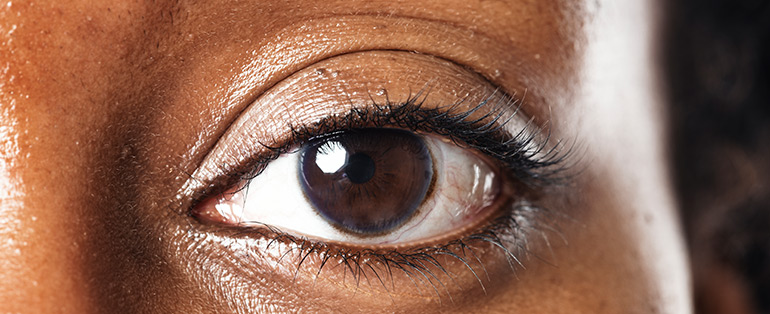Zoom em um dos olhos castanhos de uma pessoa negra usando lentes de contato. 
